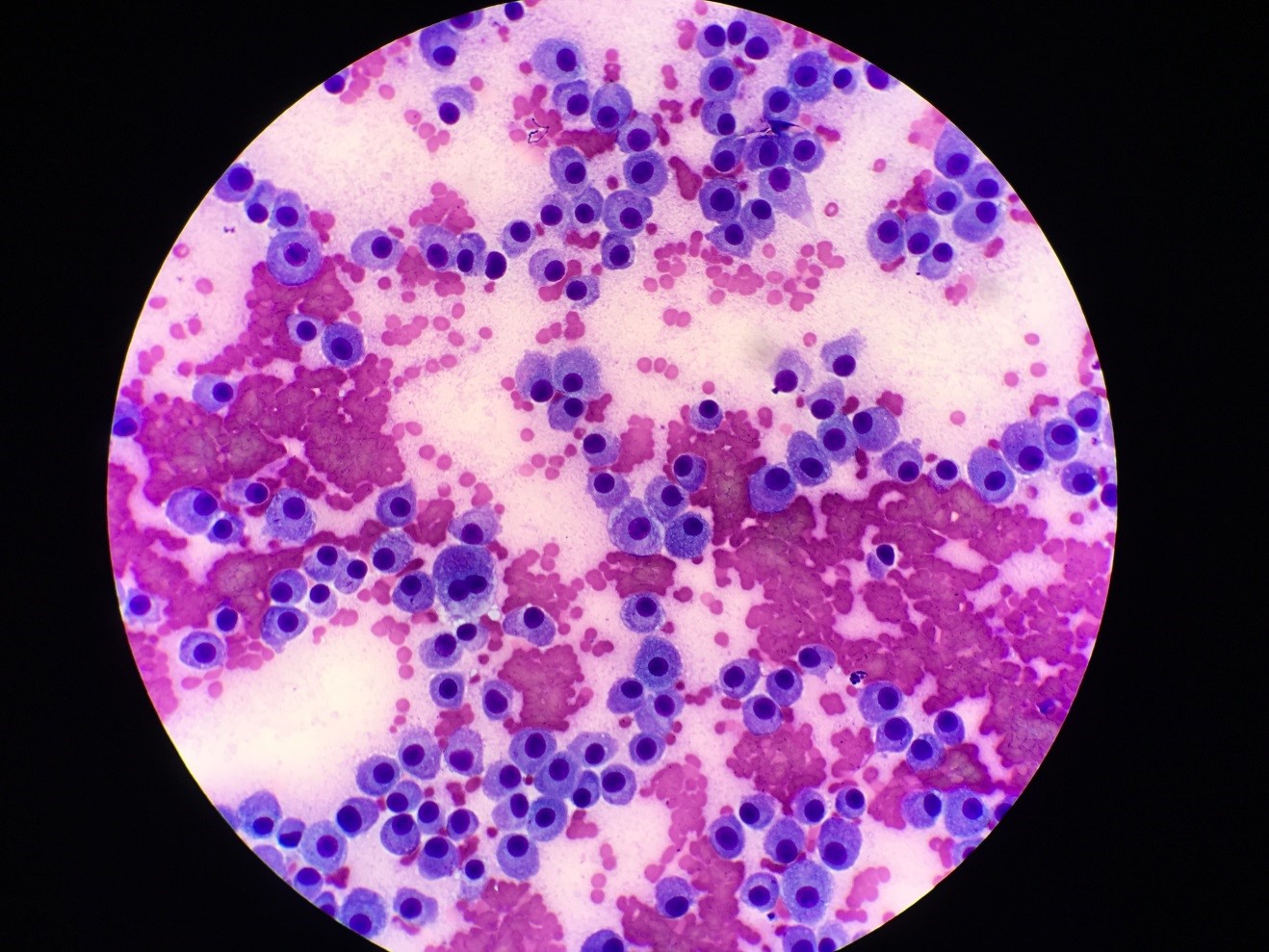 Pages Case of the Month Cutaneous Mass